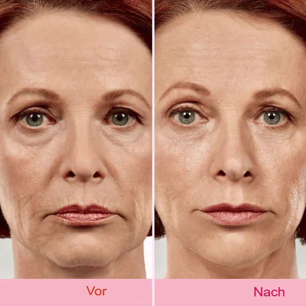 Unsichtbares Lifting-Tape für das Gesicht – V-Form Anti-Falten